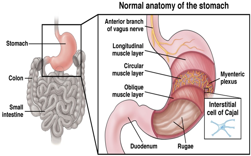  Kadar Gula Darah Tinggi Picu Gastroparesis, Apa Itu?