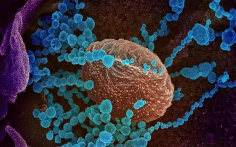  Virus Corona Varian Lambda Diprediksi Lebih Menular Dibanding Delta