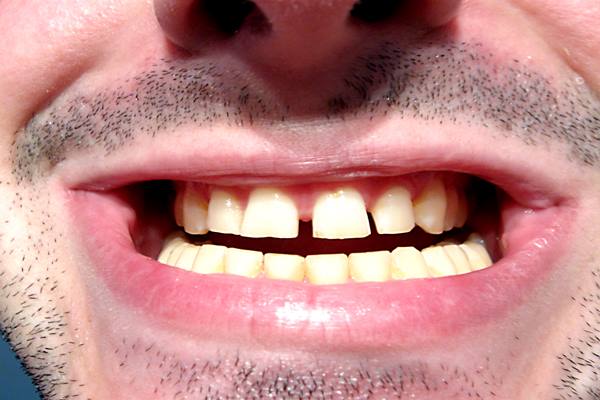  Simak 5 Tips Sederhana Tingkatkan Kesehatan Mulut