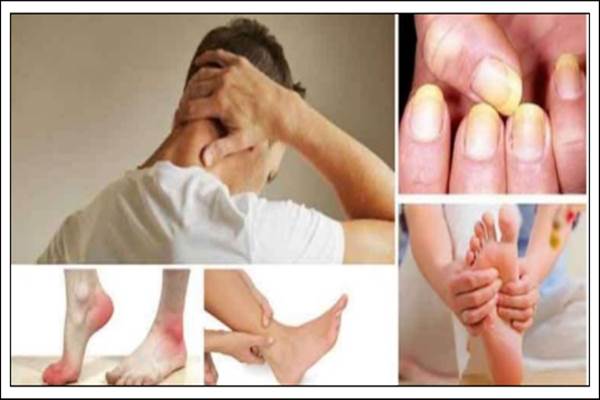  Tips Sehat, 10 Cara Menurunkan Kolesterol