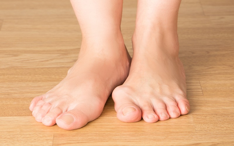  Kenali Gejala dan Pengobatan Asam Urat Bagi Laki-laki dan Perempuan