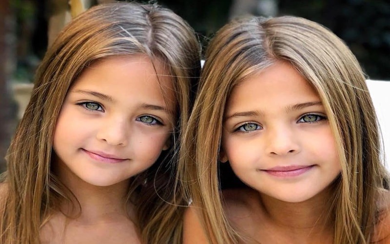 Ini Dia Kembar Tercantik di Dunia, Masih Berumur 11 Tahun
