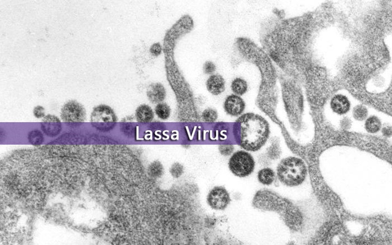  Muncul 2 Kasus Virus Lassa di Inggris, Apa Itu?