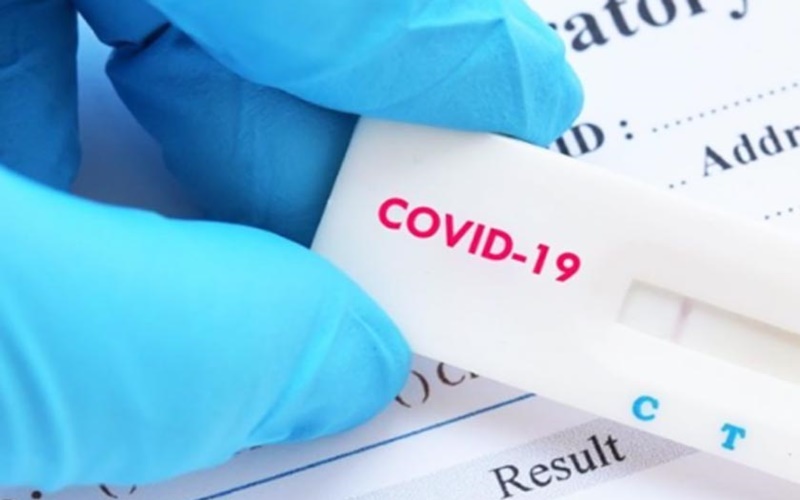  Cek Fakta : Tes Antigen Covid Tidak Akurat karena Hanya Mendeteksi Tingkat Antibodi