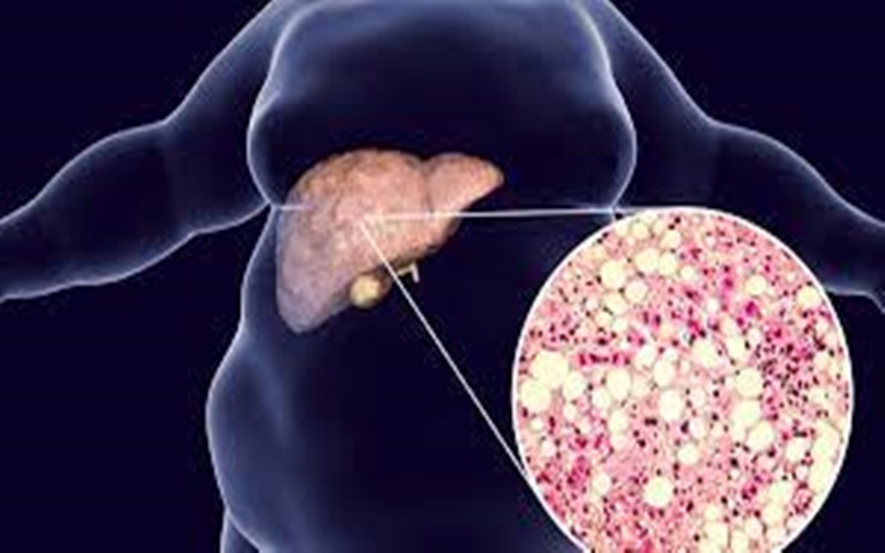  6 Tips Menjaga Liver Anda Tetap Sehat 