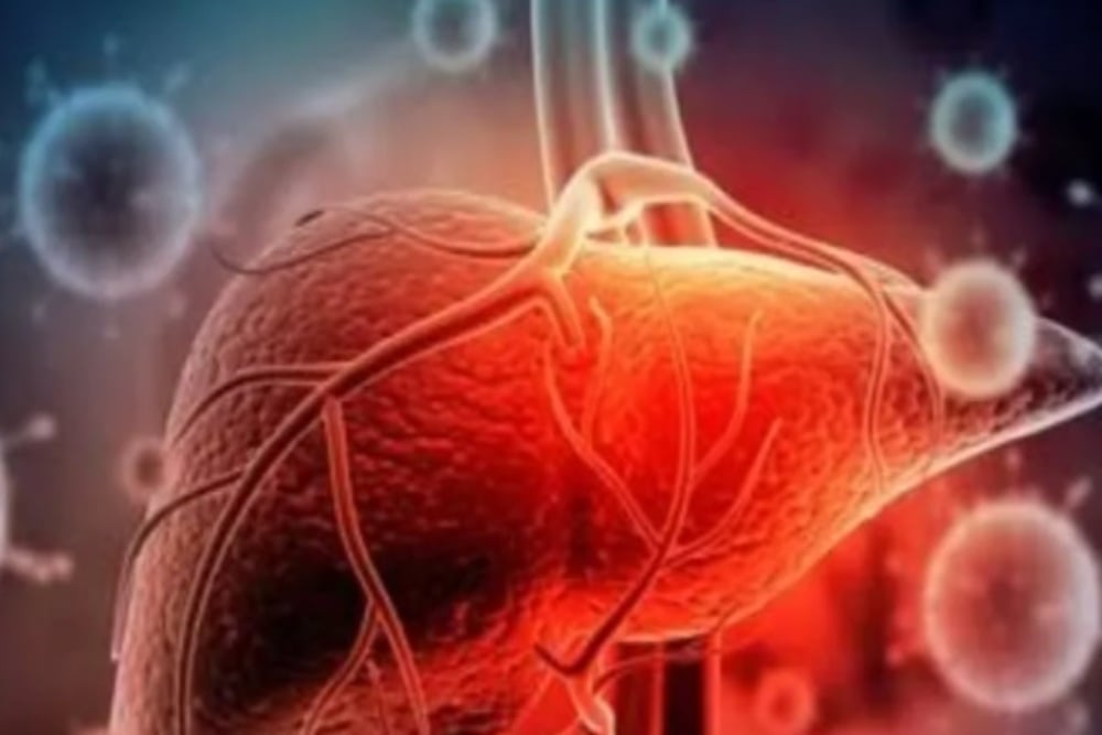  Benarkah Hepatitis Akut Misterius Berkaitan dengan Covid-19?