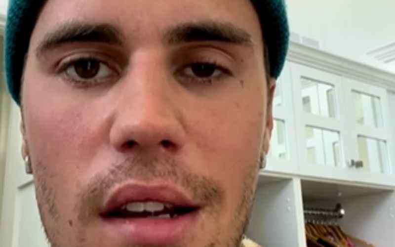 Justin Bieber umumkan ke penggemar ia mengalami sindrom Ramsay Hunt yang membuat separuh wajahnya lumpuh/Instagram @justinbieber