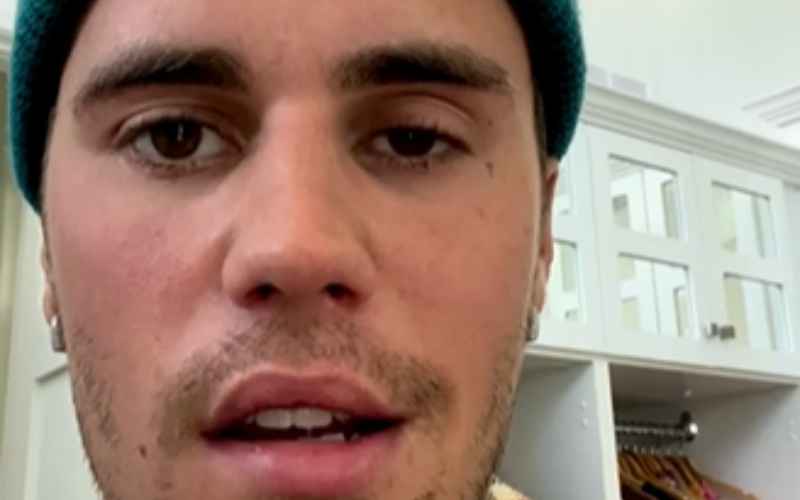  Mengenal Sindrom Ramsay Hunt yang Diderita Justin Bieber