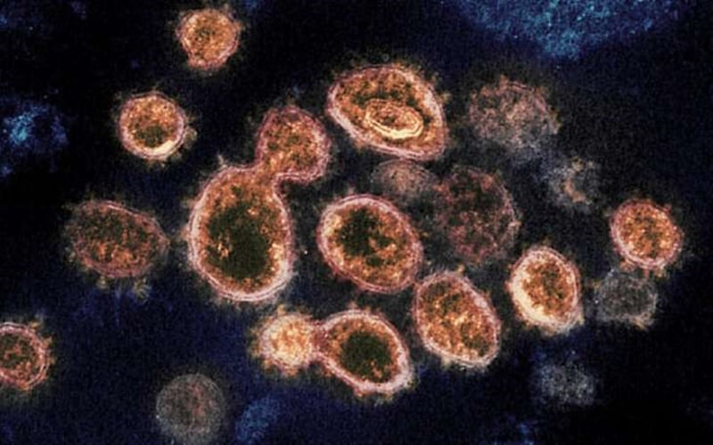  Gejala Virus Langya, yang Merebak di China