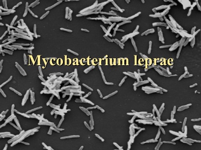 Bakteri Mycobacterium leprae penyebab kusta/slideshare.net