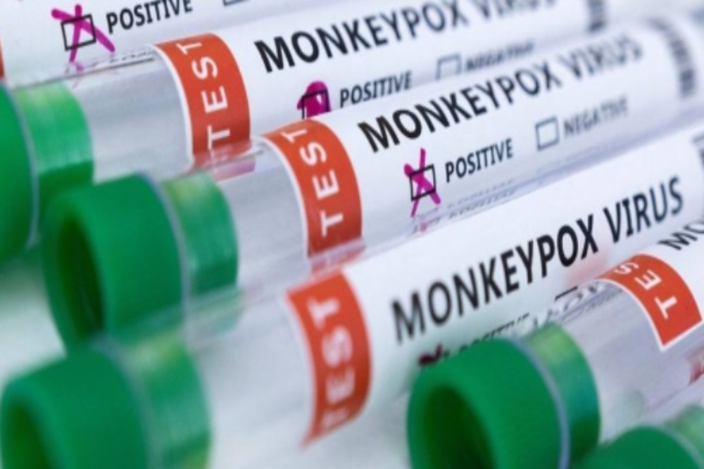 Pasien Cacar Monyet Tidak Perlu PCR untuk Tentukan Kesembuhan