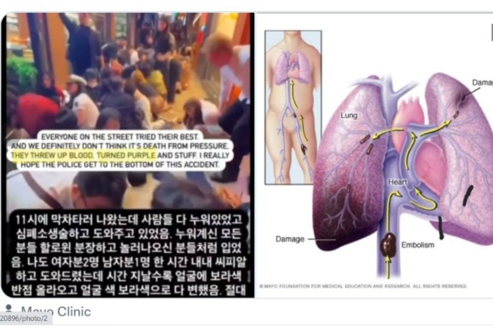  Penyakit Apa yang Menyerang Korban Halloween Itaewon?