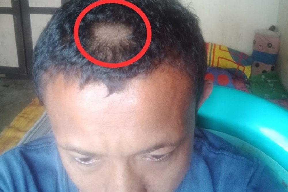 Rambut guru dipotong oleh orang tua murid di Gorontalo/Facebook Insan Dai.