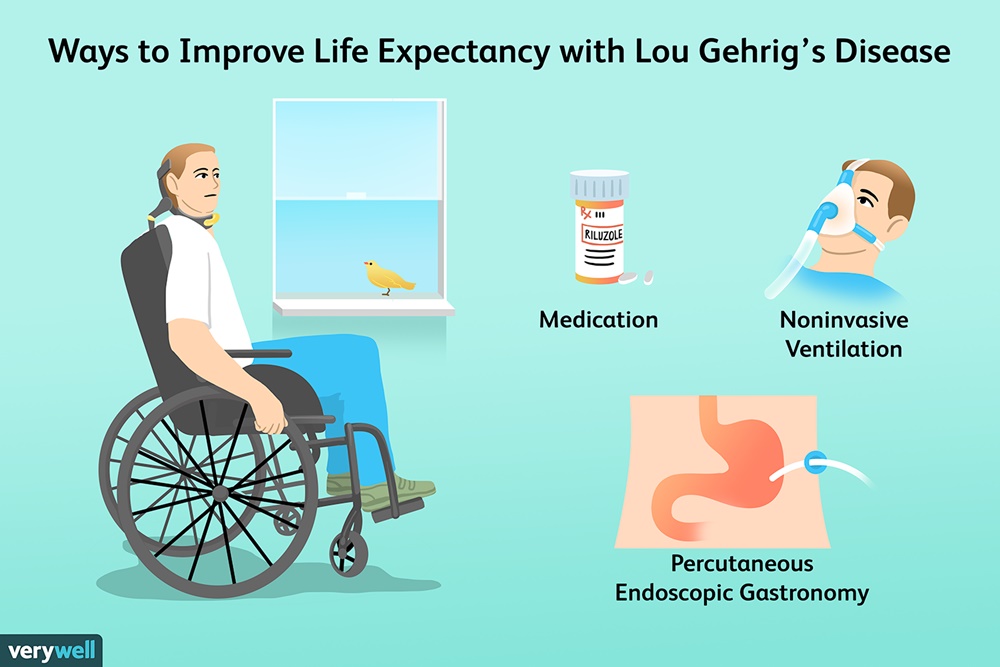  Fakta-fakta Lou Gehrig, Penyakit Langka yang Baru Saja Disetujui Obatnya