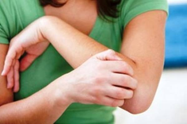  Waspada! Alergi Makanan Bisa Picu Beragam Penyakit Berikut Ini