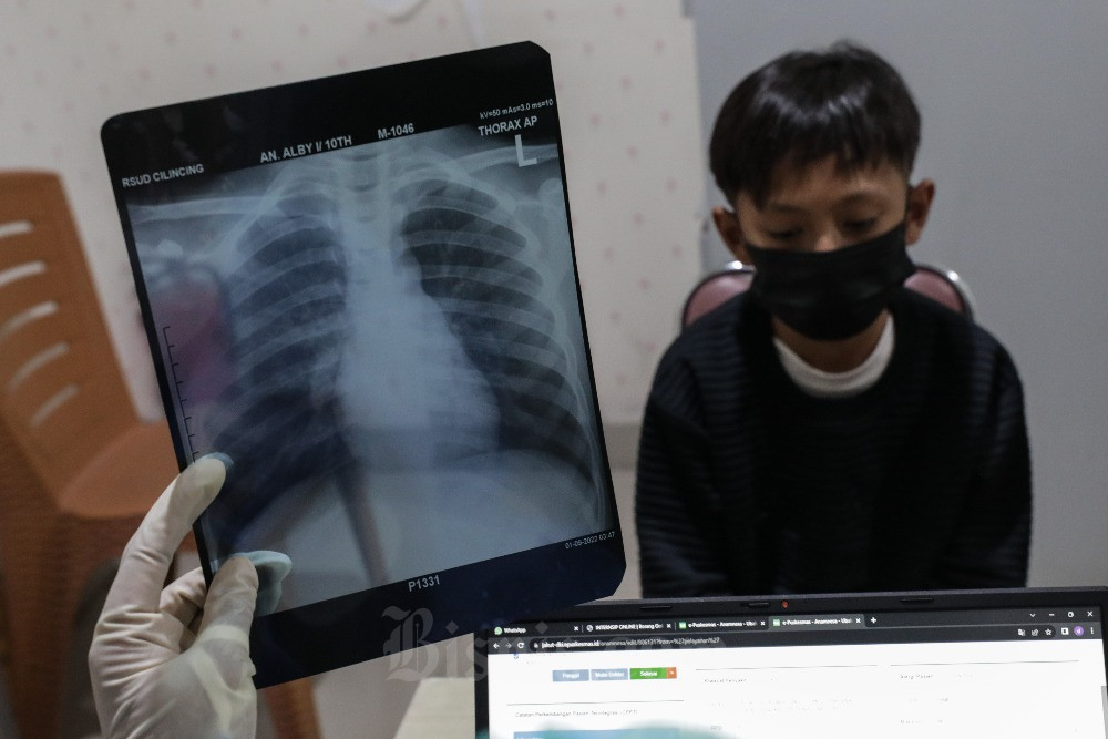  Polusi Udara Makin Tak Terkendali, Kasus Infeksi ISPA di DKI Jakarta Melonjak Tinggi