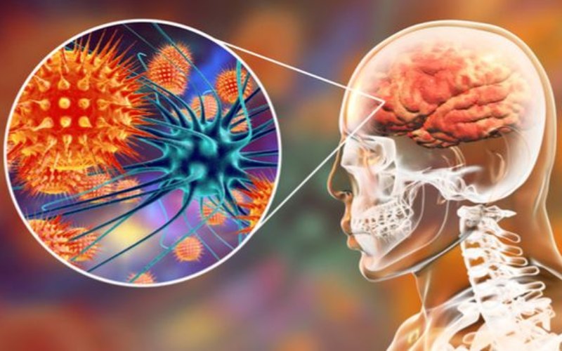 Ilustrasi penyakit meningitis/Halodoc