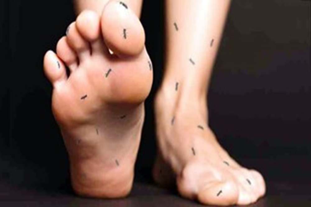  Sering Kesemutan Bisa Jadi Pertanda Penyakit Berikut Ini