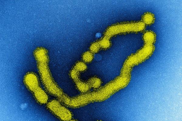 Inggris Temukan Virus Kasus Pertama Flu Manusia Mirip Flu Babi. Partikel virus flu babi (influenza tipe A subtipe H1N1)/NIAID