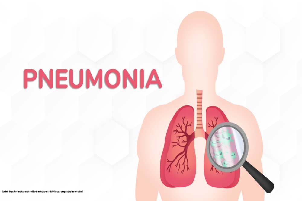 Ilustrasi pneumonia