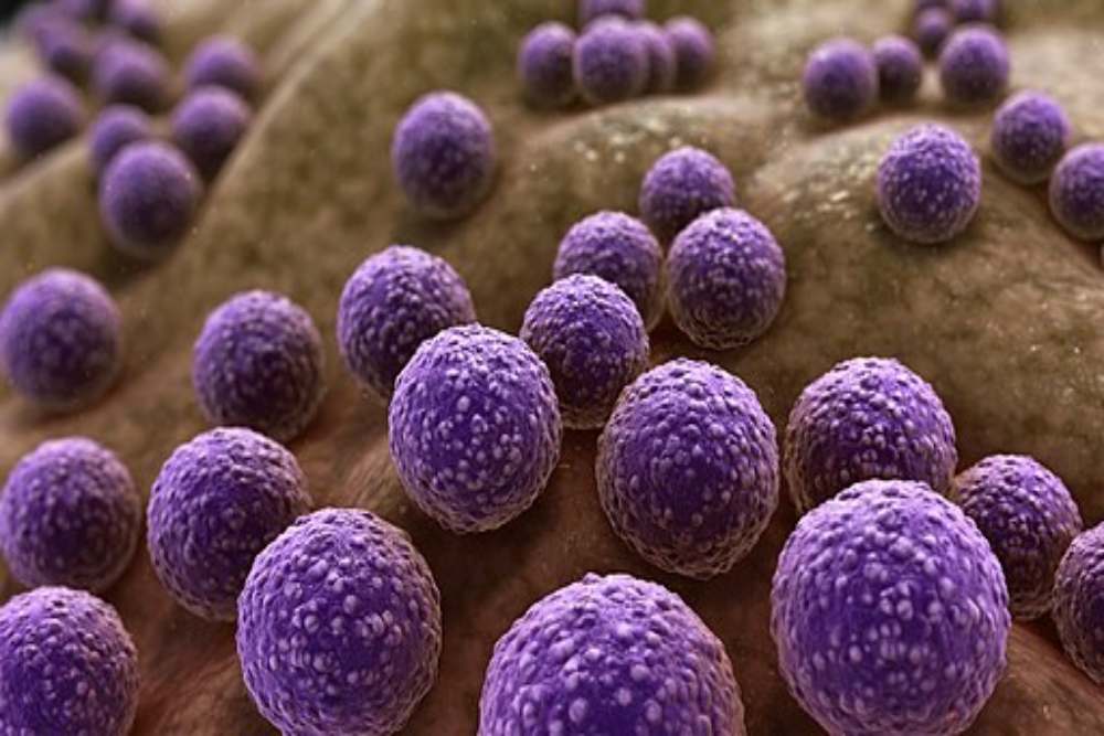  Ilmuwan Temukan Senyawa Pembunuh Bakteri yang Sebabkan Kematian