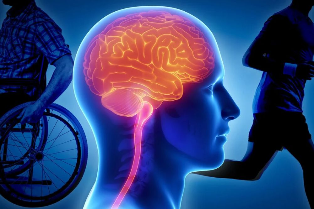  Mengenal Penyakit Saraf Multiple Sclerosis: Penyebab dan Gejalanya