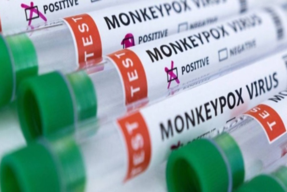 Ilustrasi vaksin cacar monyet (monkeypox). / Istimewa
