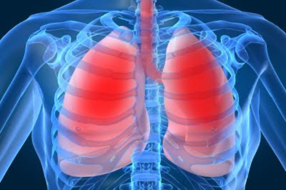  Kasus Tuberkulosis Terbesar di Indonesia Merupakan Usia Produktif