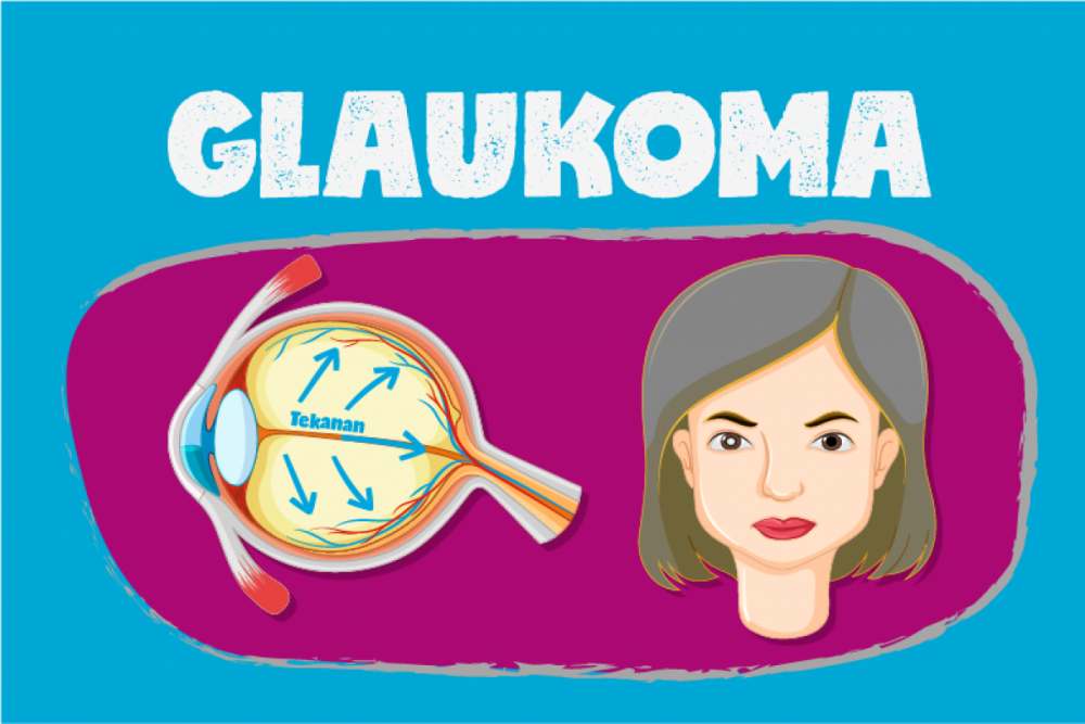  Faktor Risiko Glaukoma dan Cara Pengobatannya Sebelum Terlambat dan Sebabkan Kebutaan
