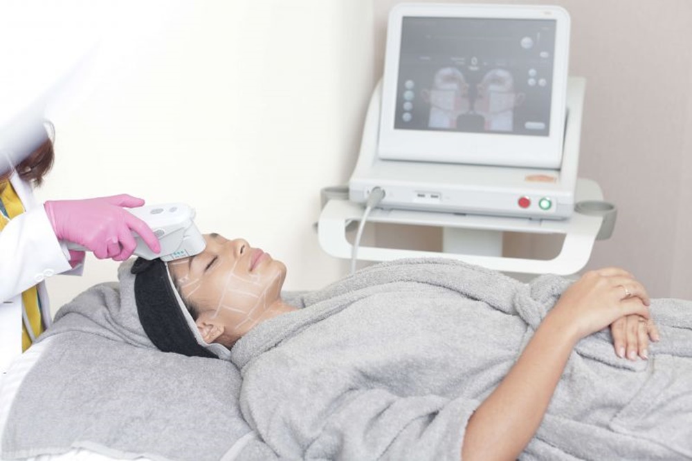 teknologi Ultherapy Prime/dokumentasi