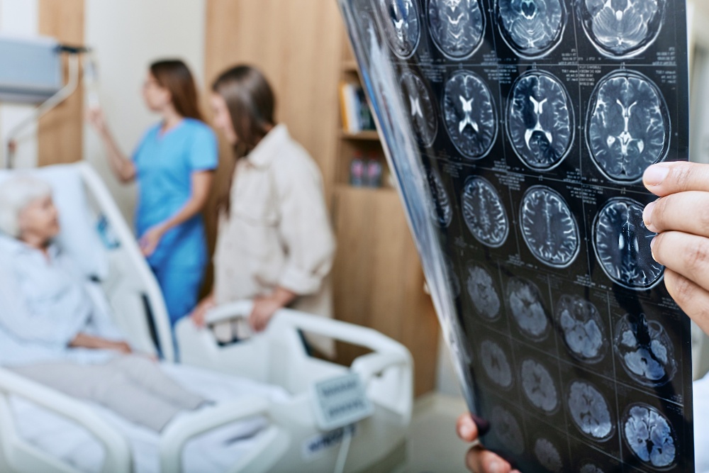  Ancaman Stroke Meningkat, Penanganan Terintegrasi Butuh Prioritas Global
