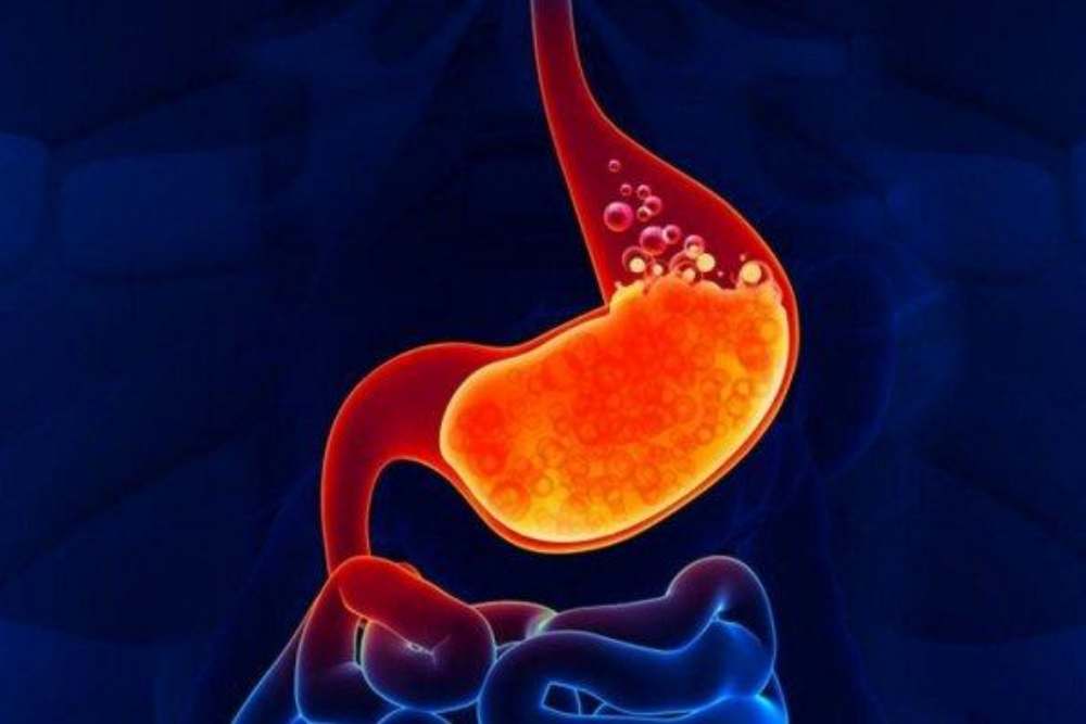  Tips Makan Daging Kurban agar Tidak Kena GERD