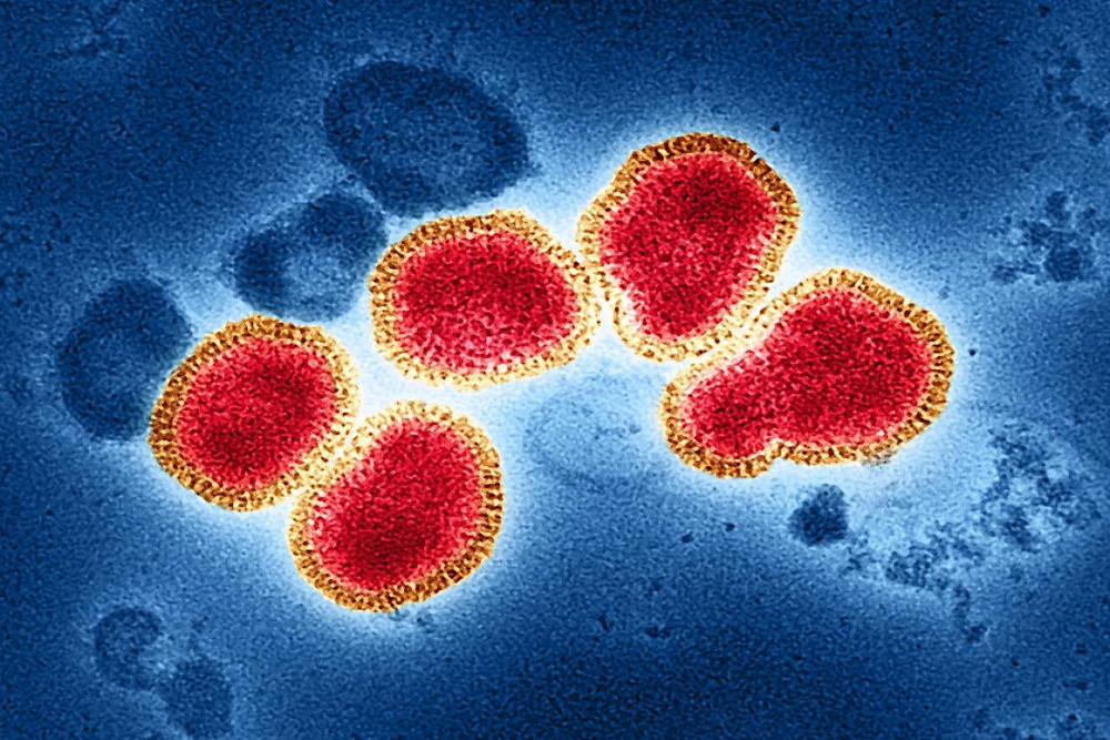 Apa Itu Hantavirus? Simak Gejala dan Efeknya ke Tubuh Manusia