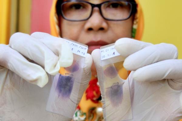 Kasus Penyakit Malaria Monyet di Aceh Barat