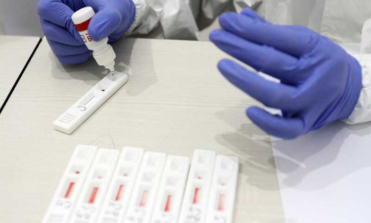 RI-GHA, Alat Rapid Test Covid-19 Buatan Indonesia Diklaim Lebih Sensitif
