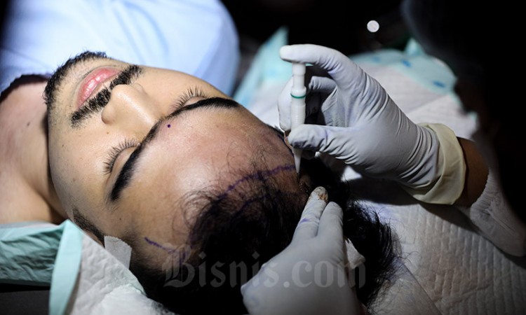 Layanan Transplantasi Rambut Dengan Teknik Terbaru