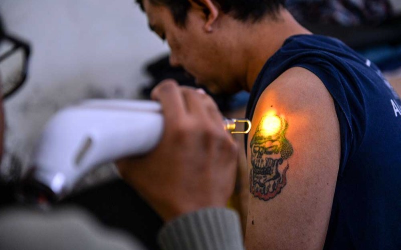 Petugas menggunakan laser khusus untuk menghapus tato seorang peserta hapus tato gratis di Masjid Al latif, Bandung, Jawa Barat, Sabtu (1/4/2023). Komunitas Hijrah Care bersama DKM Masjid Al Latif mengadakan program hapus tato secara gratis pada akhir pekan selama bulan Ramadhan. ANTARA FOTO/Raisan Al Farisi