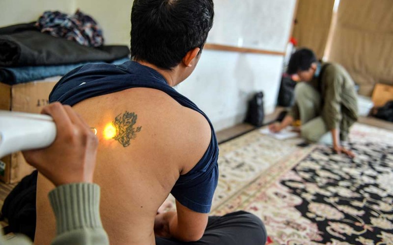 Petugas menggunakan laser khusus untuk menghapus tato seorang peserta hapus tato gratis di Masjid Al latif, Bandung, Jawa Barat, Sabtu (1/4/2023). Komunitas Hijrah Care bersama DKM Masjid Al Latif mengadakan program hapus tato secara gratis pada akhir pekan selama bulan Ramadhan. ANTARA FOTO/Raisan Al Farisi