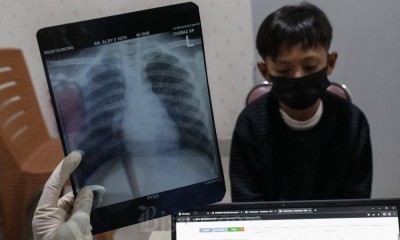 Polusi Udara Makin Tak Terkendali, Kasus Infeksi ISPA di DKI Melonjak Tinggi