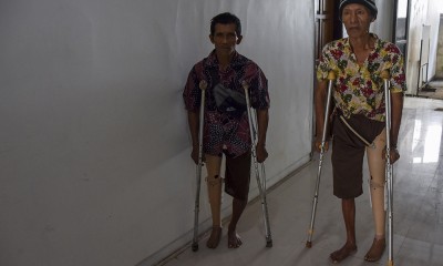 Pembagian Kaki Palsu Gratis Bagi Disabilitas di Kota Tasikmalaya