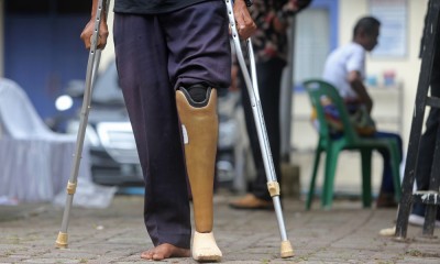 Pemasangan Bantuan Kaki Palsu Di Banda Aceh