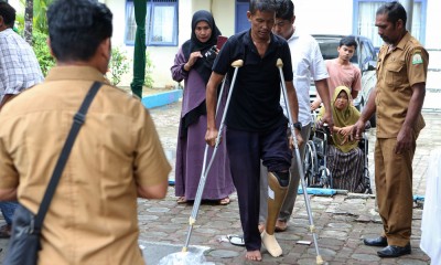 Pemasangan Bantuan Kaki Palsu Di Banda Aceh