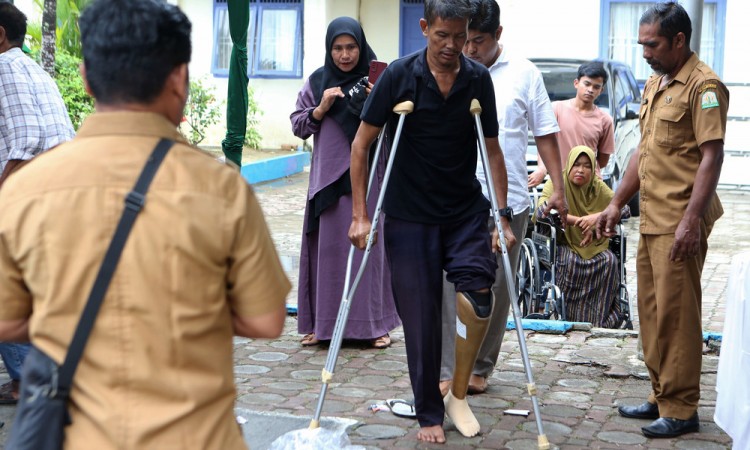 Pemasangan Bantuan Kaki Palsu Di Banda Aceh