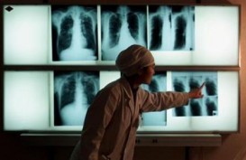 Indonesia Hadapi Kasus TB MDR dan TB Dengan HIV