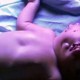 Bayi Bermuka Dua Lahir di India