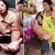 Wanita Ini Memiliki Tangan Seberat 10 KG