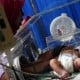 Satu Dari Enam Bayi Indonesia Lahir Prematur