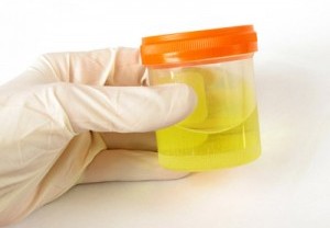 Duh, Kiper Swiss Ini Minum Urine saat Pertandingan