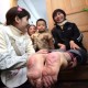 Wanita China Berkaki Terbalik Bisa Hidup Normal