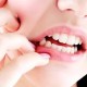 Wahh, 12,04 Juta Warga Jawa Barat Alami Masalah Gigi